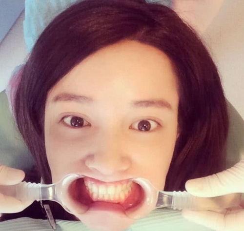 娱乐圈吃瓜张大奕